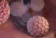 HPV زگیل تناسلی