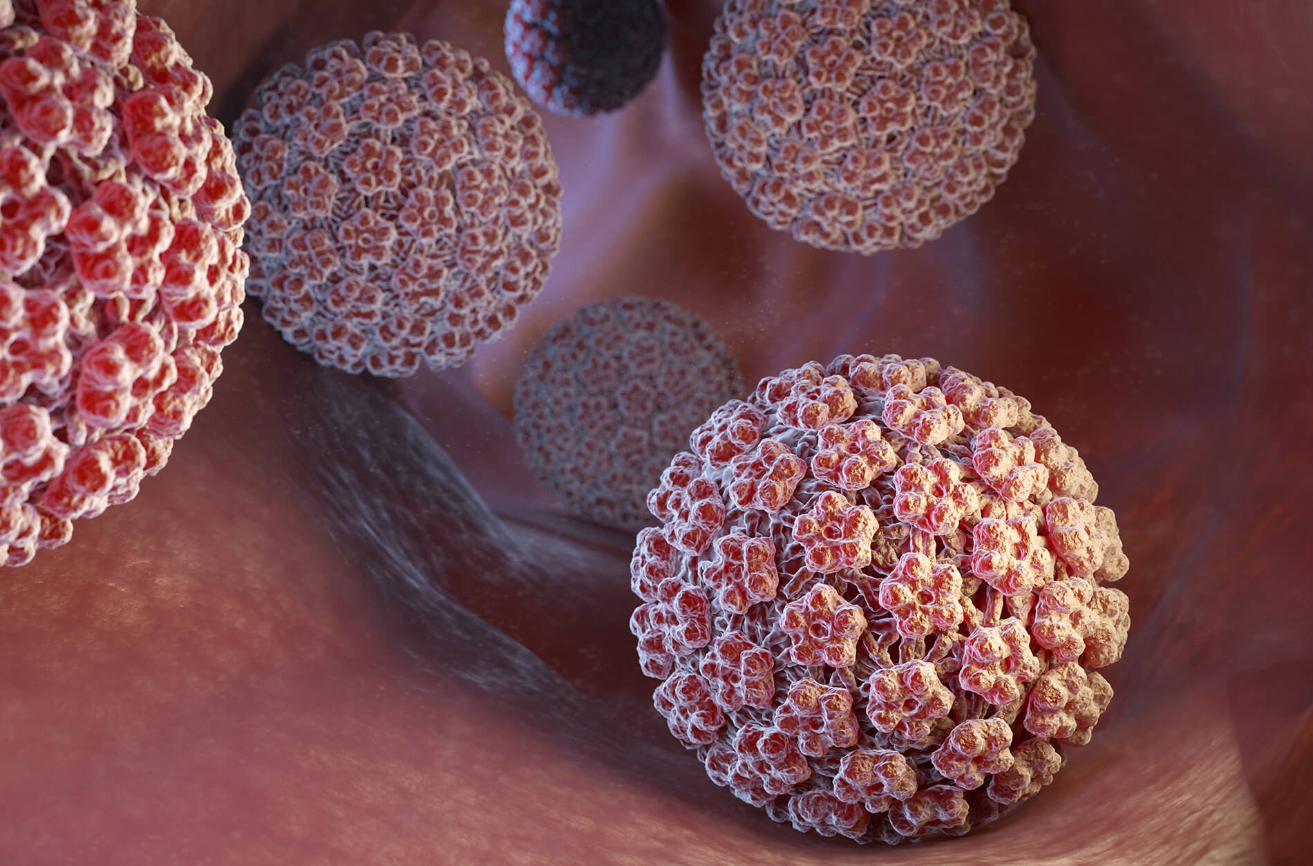 HPV زگیل تناسلی